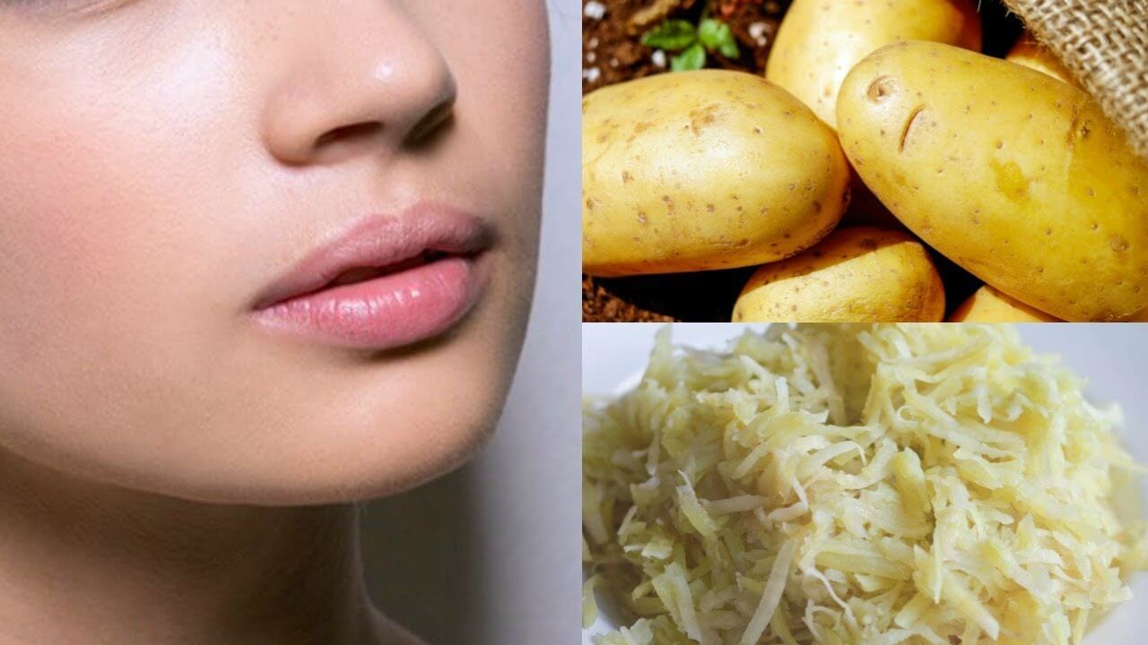 ব্ল্যাকহেডস দূর করবে আলু