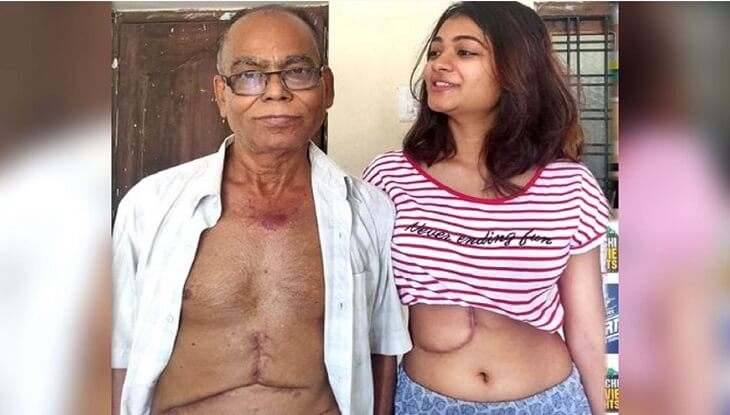 মেয়ের যকৃতে বাঁচল বাবা